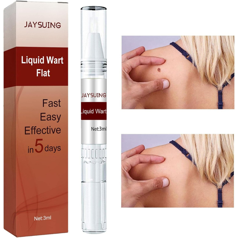Buy 1 Get 1 Free OFFER🔥Liquid Wart and Skin Tag Removal