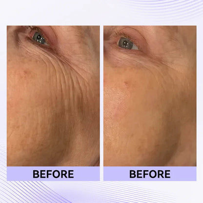 Instant Face Tightener