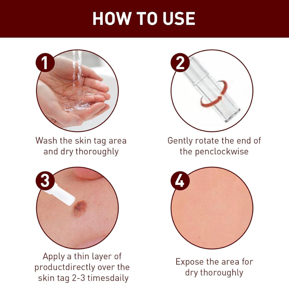 Buy 1 Get 1 Free OFFER🔥Liquid Wart and Skin Tag Removal